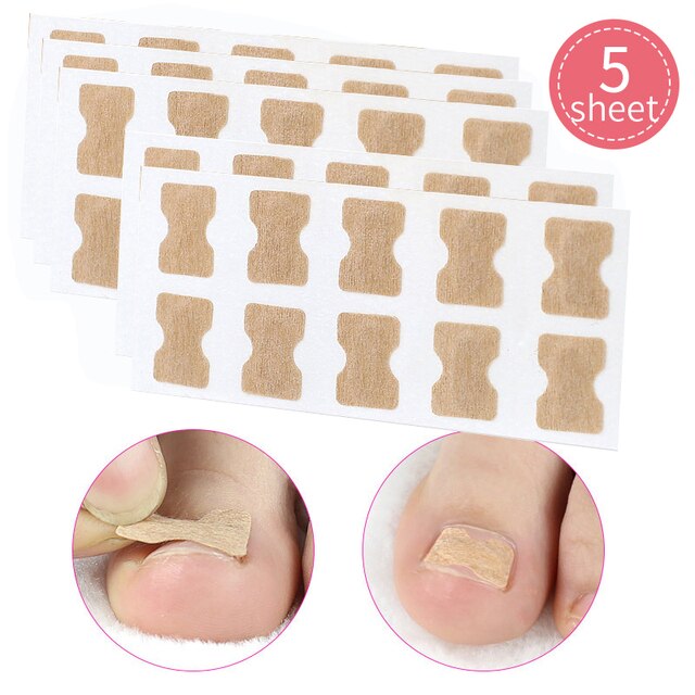 Ingrown Toenail Corrector Stickers