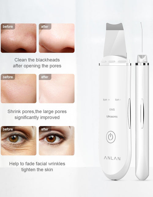 Load image into Gallery viewer, Ultrasonic Skin Lift Machine
