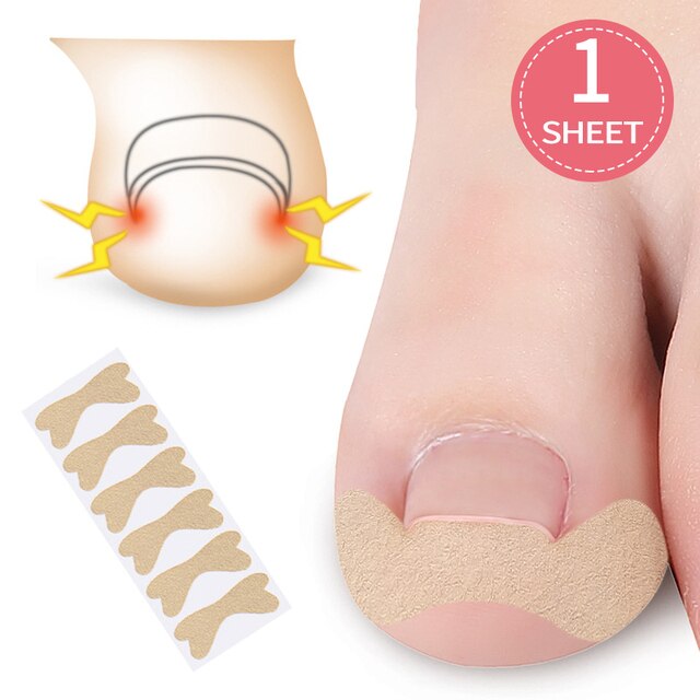 Ingrown Toenail Corrector Stickers