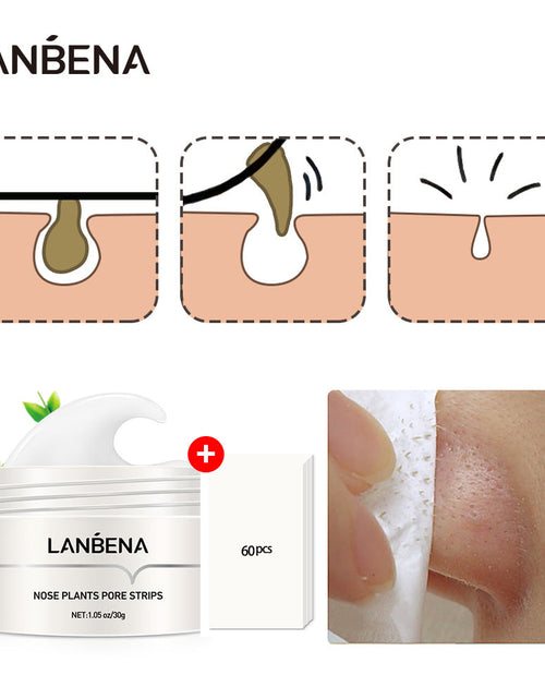 Load image into Gallery viewer, Blackhead Remover Mask
