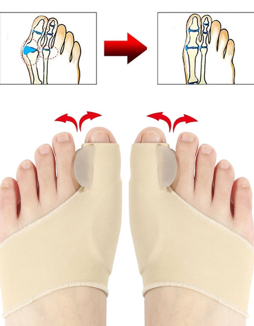 Load image into Gallery viewer, Toe Separator Bunion Corrector
