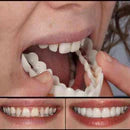 Removable Dental Lens