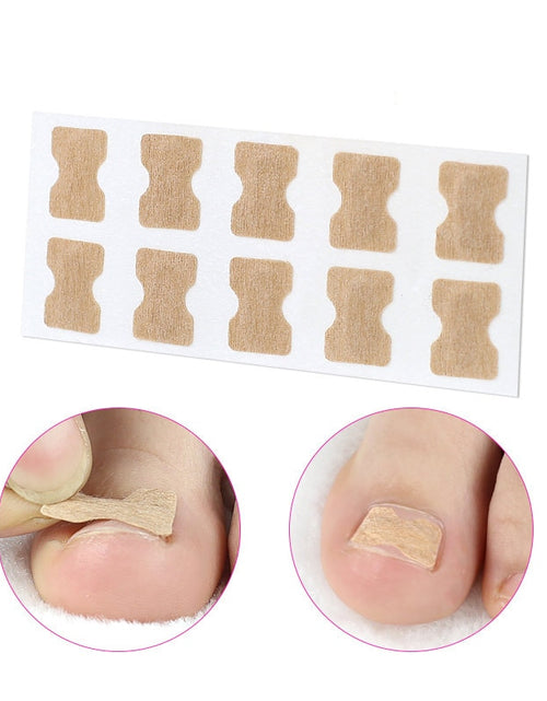 Load image into Gallery viewer, Ingrown Toenail Corrector Stickers
