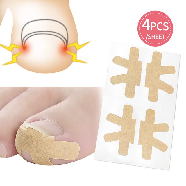 Ingrown Toenail Corrector Stickers